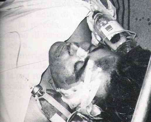 Il brigatista Prospero Gallinari, ferito nello scontro a fuoco in cui venne catturato il 24 settembre 1979.